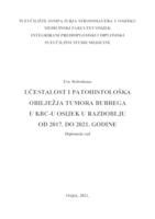 Učestalost i patohistološka obilježja tumora bubrega u KBC-u Osijek u razdoblju od 2017. do 2021. godine