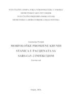 Morfološke promjene krvnih stanica u pacijenata sa SARS-CoV-2 infekcijom