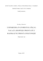 Usporedba patohistoloških nalaza biopsije prostate i radikalne prostatektomije u KBC Osijek